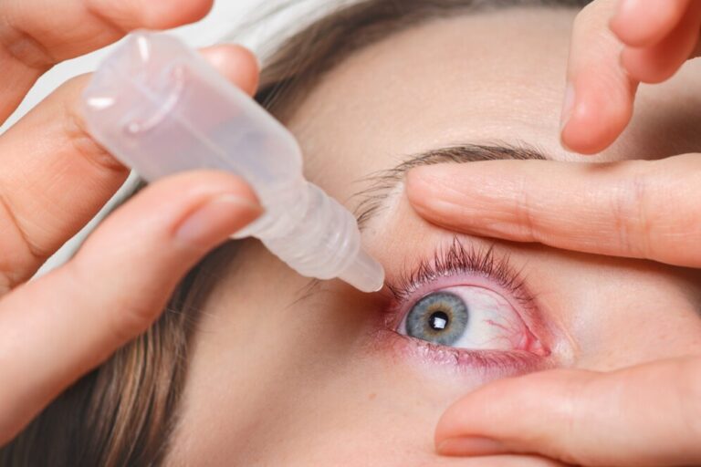 Preventing Eye Infections