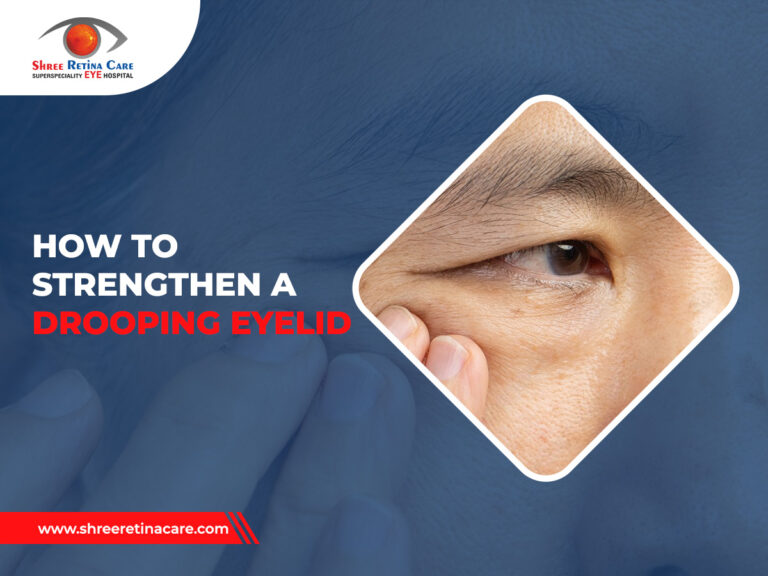 How to Strengthen a Drooping Eyelid with Top Eye Hospital in Raipur, Chattisgarh