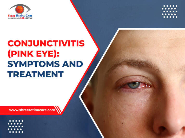 Conjunctivitis (Pink Eye)- Explore Symptoms and Treatment