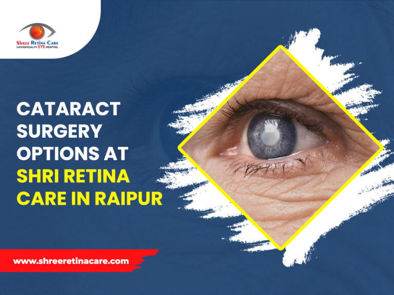 Cataract Surgery Options at Shri Retina Care in Raipur