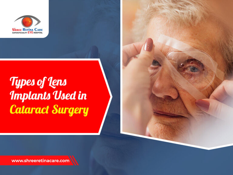 Types of Lens Implants Used in Cataract Surgery