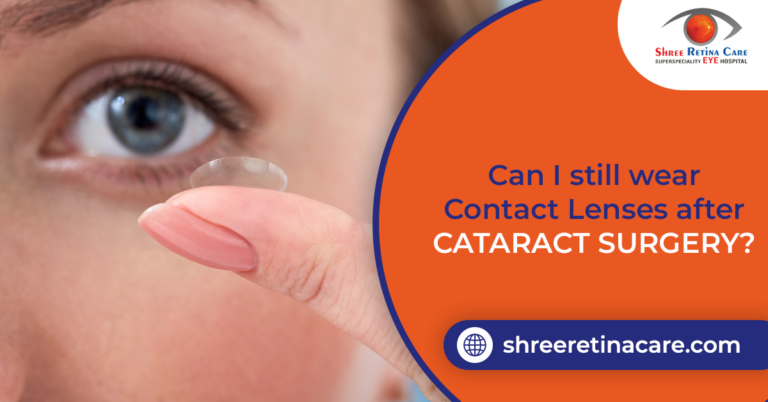 "Cataract surgery in raipur