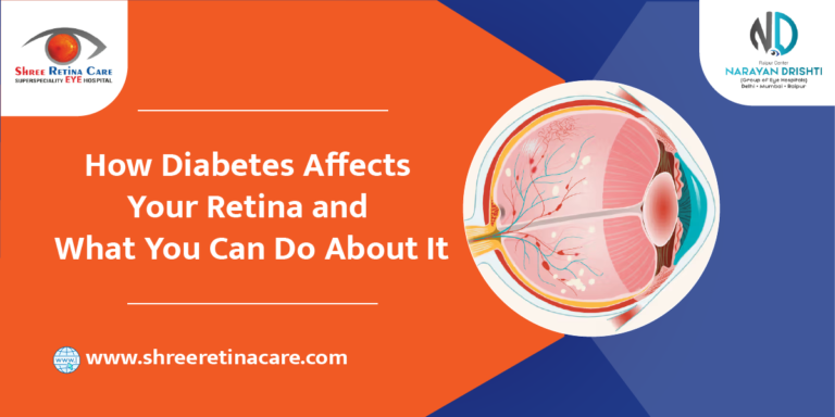 How Diabetes Affects Your Retina and What You Can Do About It