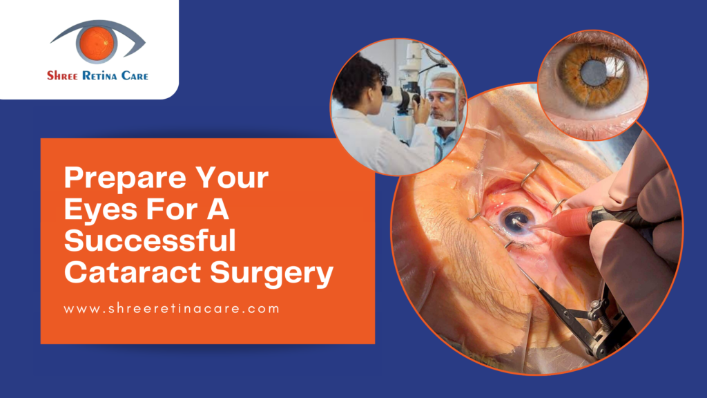 Prepare Your Eyes For A Successful Cataract Surgery