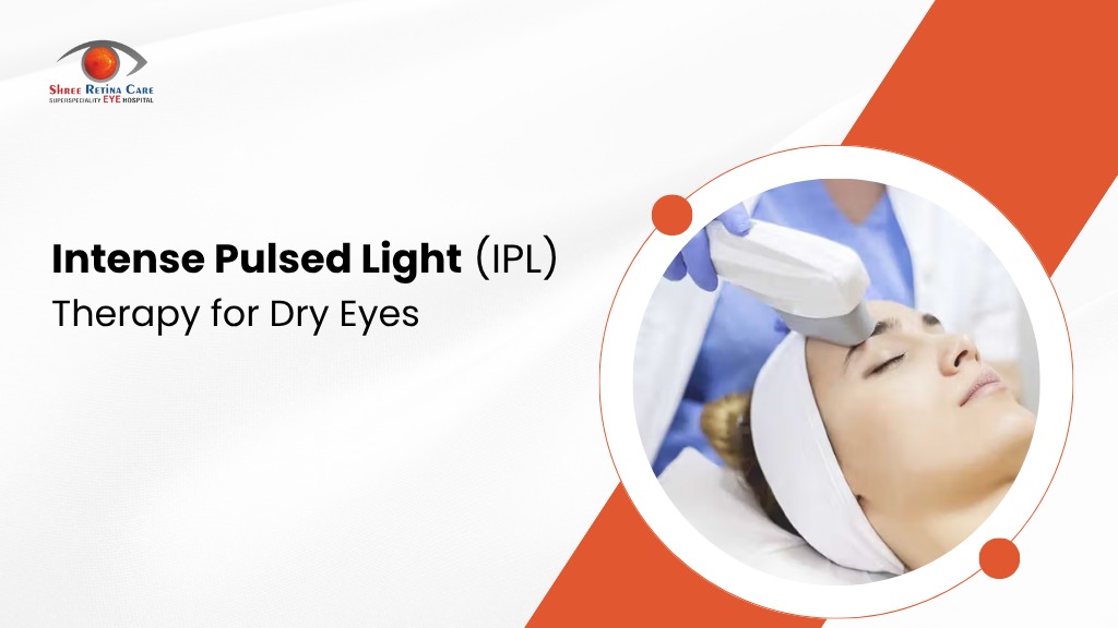 Intense Pulsed Light (IPL) Therapy for Dry Eyes