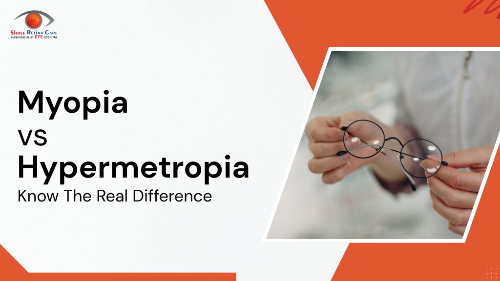Myopia vs Hypermetropia