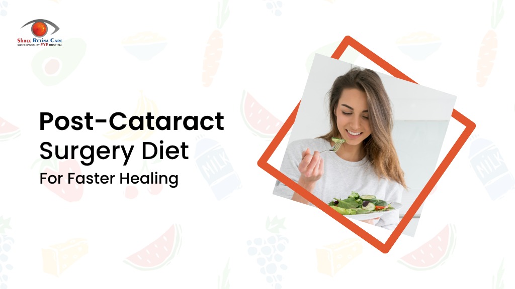 Post-Cataract Surgery Diet