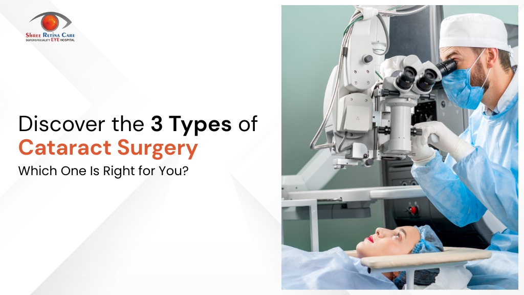 Types Of Cataract Surgery