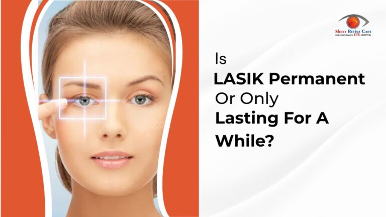 Is LASIK Permanent Or Only Lasting For A While?