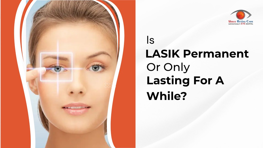 is lasik surgery permanent