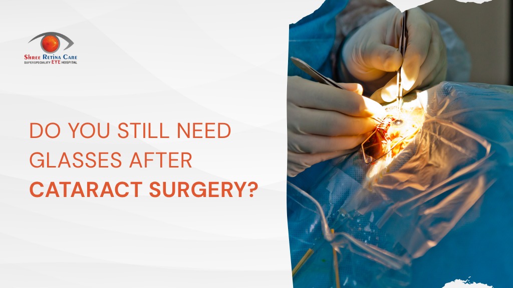Glasses After Cataract Surgery