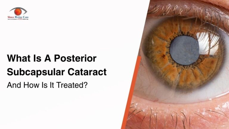 What Is A Posterior Subcapsular Cataract