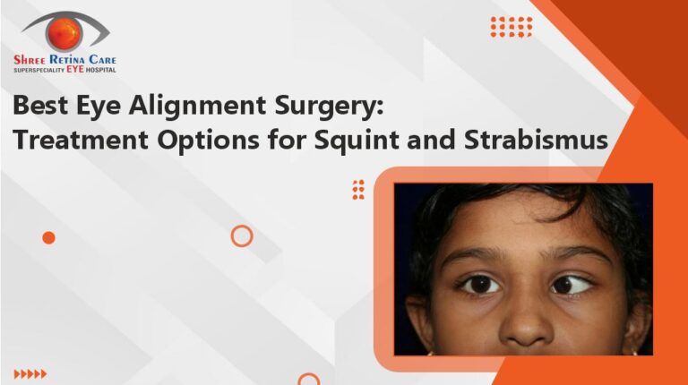 Eye Alignment Surgery Options for Squint and Strabismus