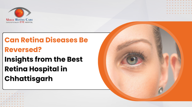 Can Retina Diseases Be Reversed? Insights from the Best Retina Hospital in Chhattisgarh for