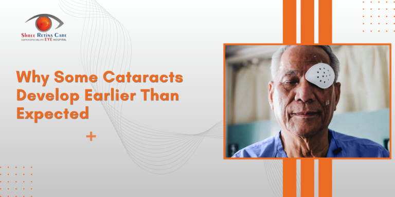 Why Some Cataracts Develop Earlier Than Expected