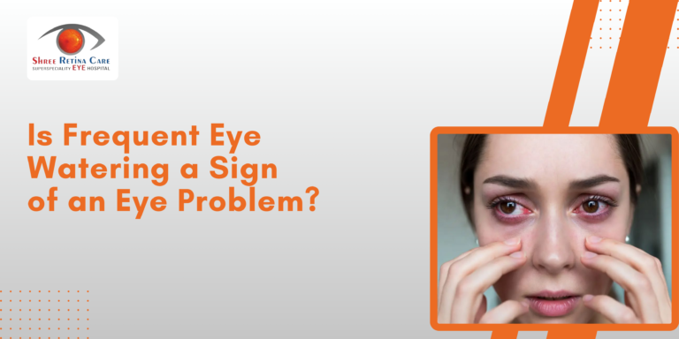 Is Frequent Eye Watering a Sign of an Eye Problem?
