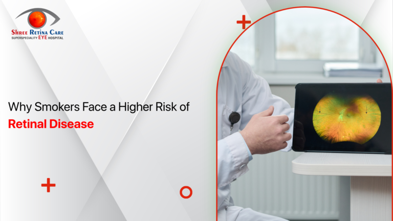Why Smokers Face a Higher Risk of Retinal Disease